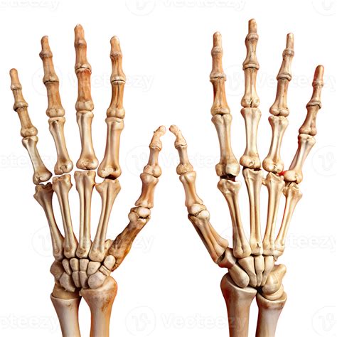 Detailed illustration of human hand skeletons with all bones visible ...