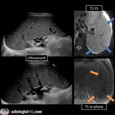 Image result for Ultrasound Lab