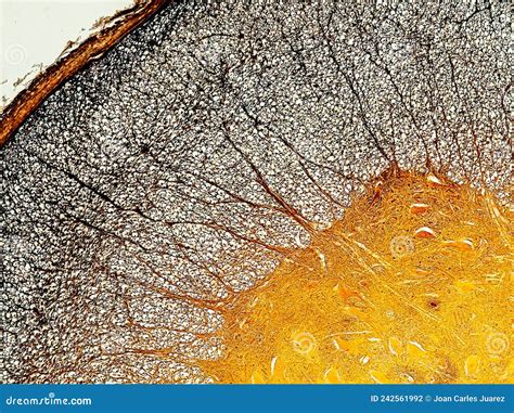 Spinal Cord Cross Section Under the Microscope Showing Neurones and ...