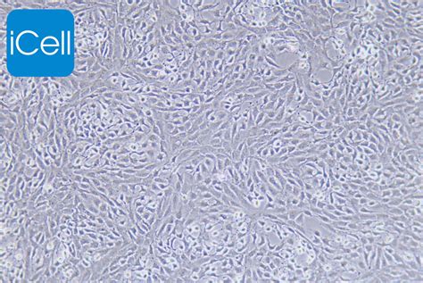 THP-1 cells | Leukemia | CLS