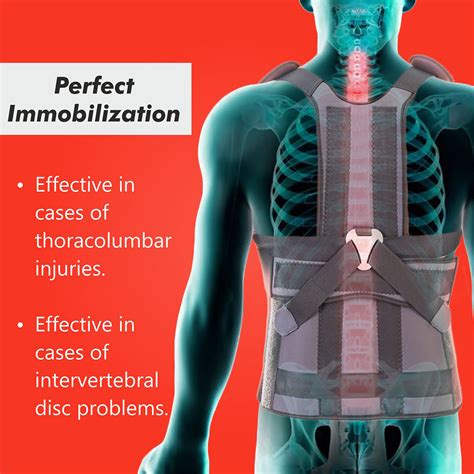 Buy Samson Taylor's Brace Online: Effective Support Solution - Samson ...