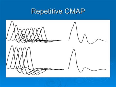 Image result for Repetitive Nerve Stimulation Test
