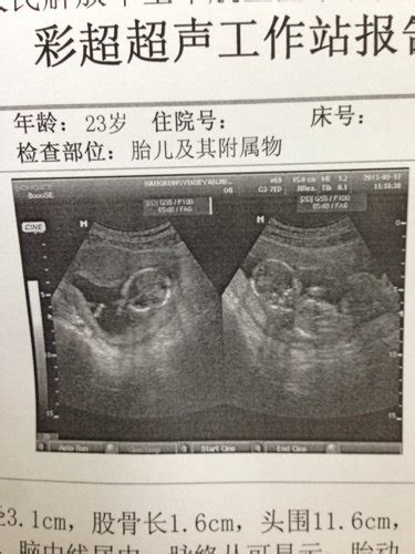 媳妇怀孕48天了，三次BC检查时间分别是4月4日，10日，19日（怀孕48天） 孩子发育健康吗？求解！！！ - 百度宝宝知道
