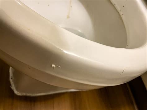 Exploding Poop Human 的图像结果