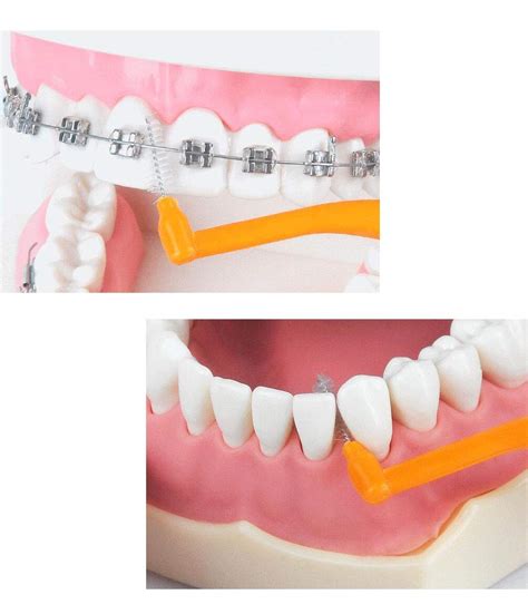 Buy Dr reddy's CLOHEX-NS Interdental Brush Wide Spaces- Slim ...