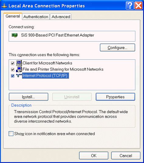 Local Area Connection Properties 的图像结果