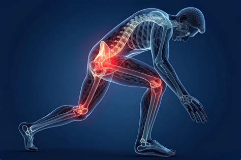 Is It Arthritis or Joint Pain? Signs, Symptoms & Treatment
