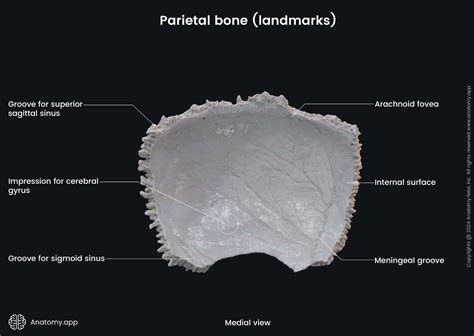 Parietal Bone Anatomy Cranial Vault Fracture