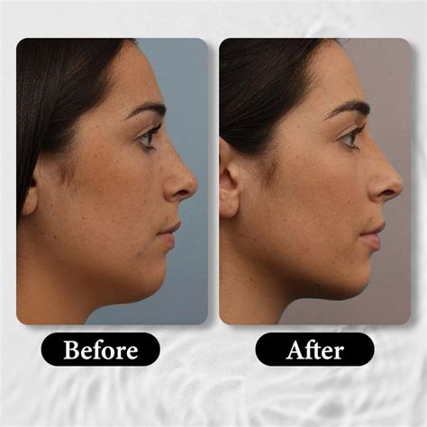 Best Age Less Anti-Aging Facial Mask For Sagging And Youthful Skin ...