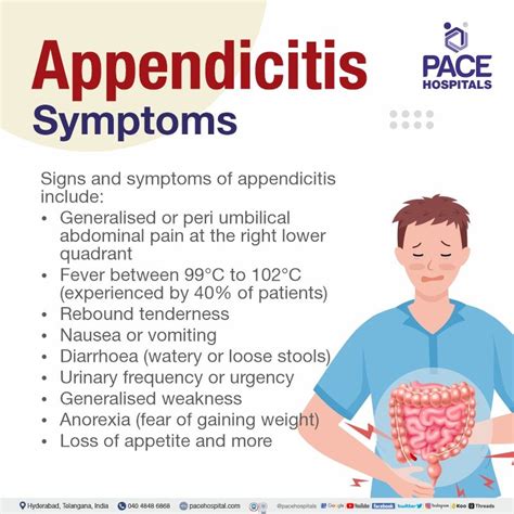 Image result for Appendicitis Left Side