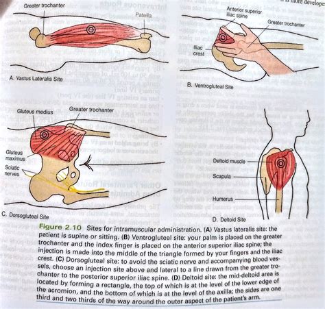 #Pharmacology #injection sites for intramuscular administration | Online nursing schools ...