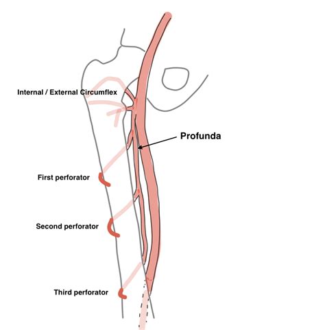 Deep Femoral Artery Profunda Femoris