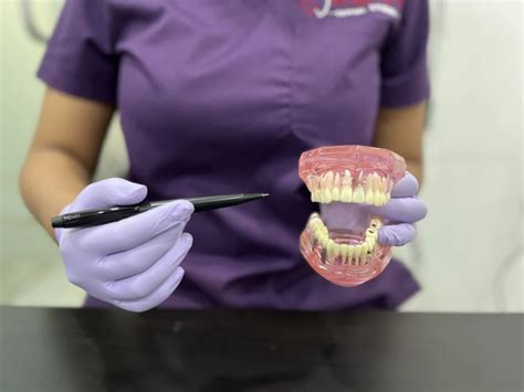 Best Dentist in Malad |Top Dental Clinic Near Me |Dr Supriya