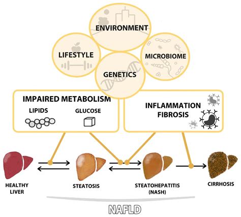 Innovative Therapeutic Approaches in Non-Alcoholic Fatty Liver Disease: When Knowing Your ...