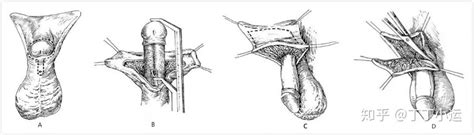 Image result for Lightgbm Xgb Example Python