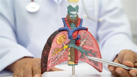 Lungs Cancer : खोकला जास्त काळ टिकला तर दुर्लक्ष नको, असू शकतं ...