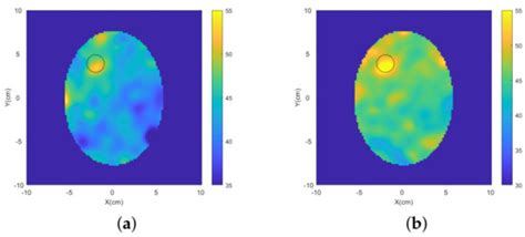 Metasurface-Enhanced Antennas for Microwave Brain Imaging