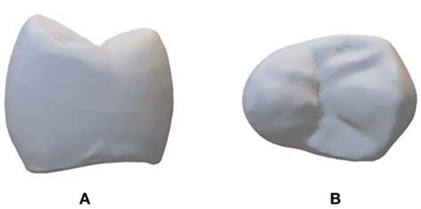 The Fracture Resistance of Additively Manufactured Monolithic Zirconia ...