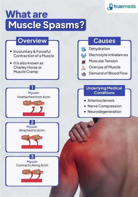 Muscle Spasms Treatment Muscle Spasms: Causes, Diagnosis, And