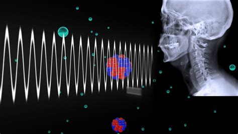 How Do X-rays Work? | Matter science, X ray, Biomedical