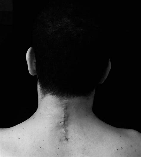 Blood, Snot and Tears: A celebration of life and disability