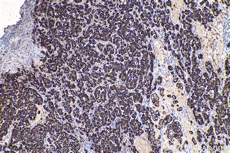 IHCeasy AGR2 Ready-To-Use IHC Kit KHC0653 | Proteintech