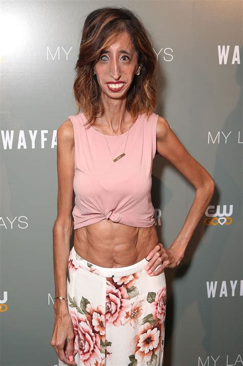 Lizzie Velasquez, Once Called the ‘World’s Ugliest Woman,’ Responds to Cruel Body Shaming Meme