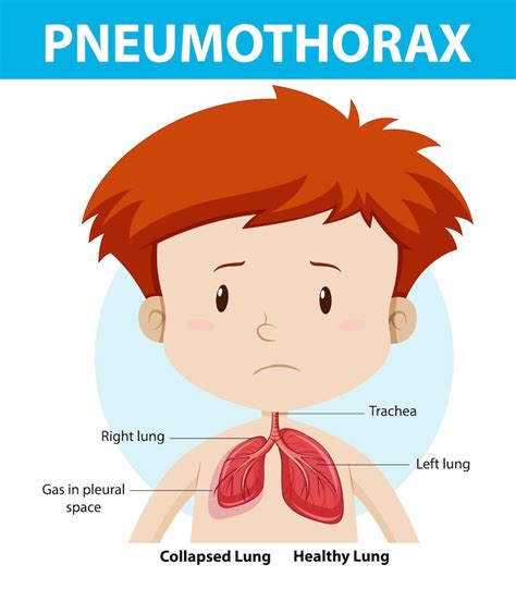 Page 20 | Images de Anatomie Poumons – Téléchargement gratuit sur Freepik