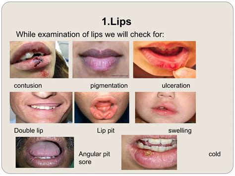 Intra oral examination | PPTX