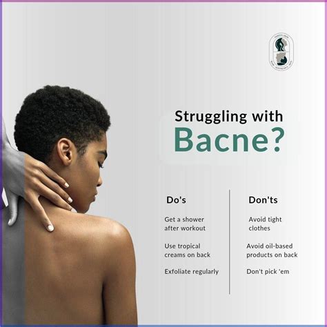 Eliminate Back Acne: 11 Effective Tips in 2025 | Bacne, Best acne treatment, Body acne