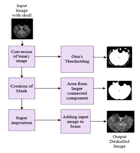 A Convolutional Mixer-Based Deep Learning Network for Alzheimer’s ...