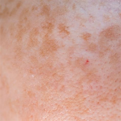 Skinaa shop- Best Skincare Products In India Online