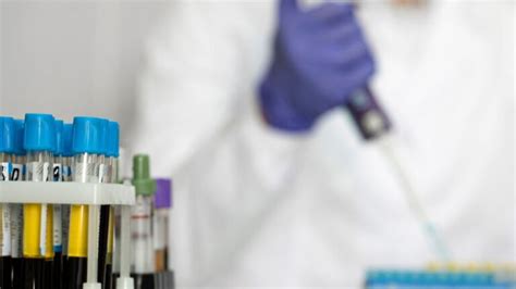 Chromosomal Array Testing 的图像结果