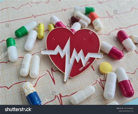 Ecg Ventricular Pacing Rhythm Artificial Pacemaker Stock Photo ...