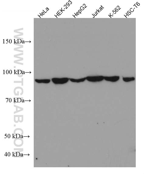 VPS53 antibody (67610-1-Ig) | Proteintech
