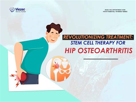 Improved Treatment: Stem Cell Therapy For Hip Osteoarthritis
