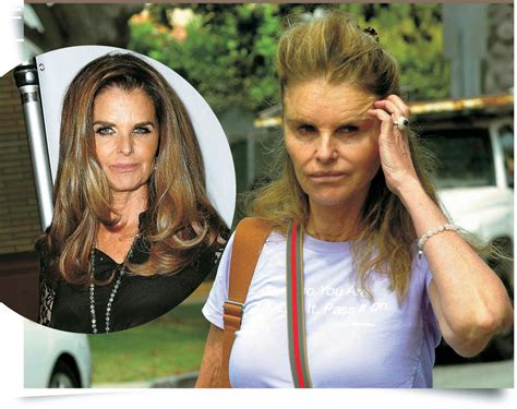 Plastic Surgery Disasters 的图像结果