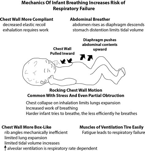 Pediatric Airway Risks: Inefficient Mechanics of Breathing - The Airway Jedi