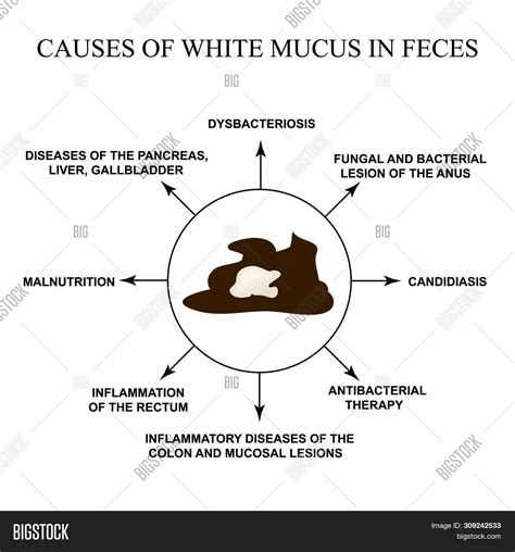 White Fluffy Mucus In Stool