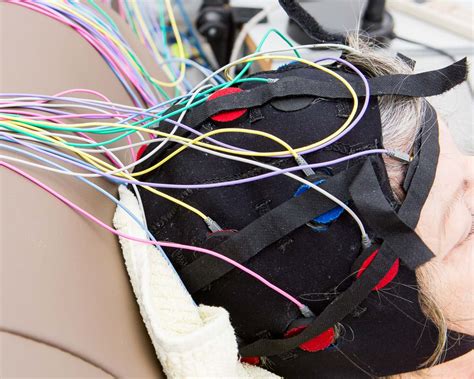 Image result for Neurophysiology Testing