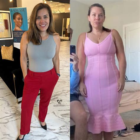 Semaglutide & Tirzepatide Injections for Weight Loss - Skin Esteem Med Spa