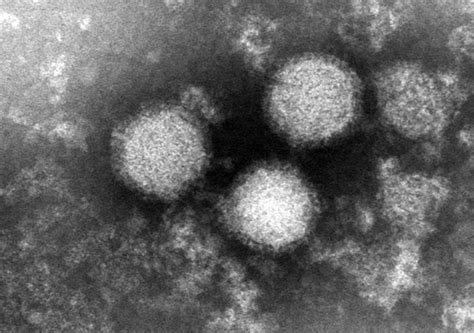Erster Fall von Mensch-zu-Mensch-Übertragung mit tödlichem Virus bestätigt