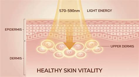 Yellow LED Light Therapy: Benefits, Uses & What to Expect | Trophyskin ...
