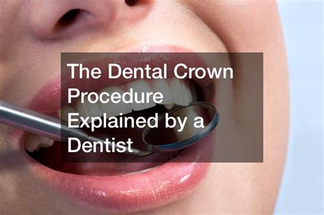 Image result for Crown Procedure