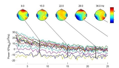 EEG MATLAB Load File 的图像结果