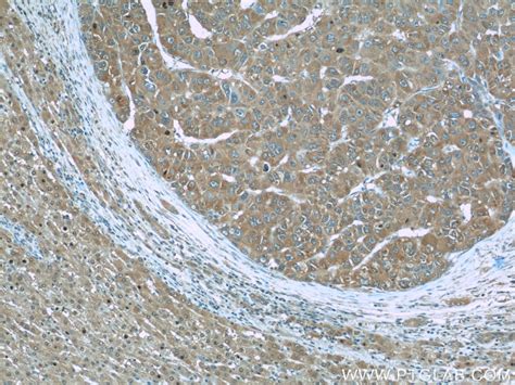 RBP4 antibody (66104-1-Ig) | Proteintech