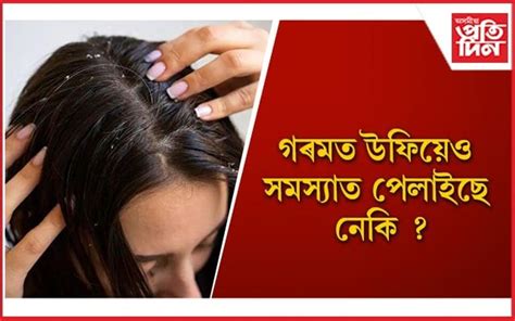 এইসমূহ ঘৰুৱা প্ৰতিকাৰৰে স্বাস্থ্যকৰ কৰি ৰাখক আপোনাৰ চুলি