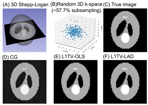 Python Non-Uniform Fast Fourier Transform (PyNUFFT): An Accelerated Non ...