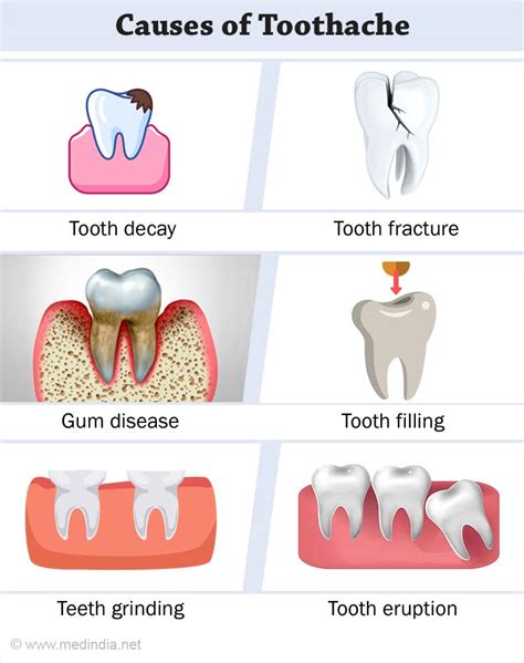 Toothache 的图像结果