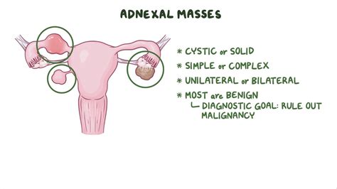 Video: Approach to adnexal masses: Clinical sciences | Osmosis